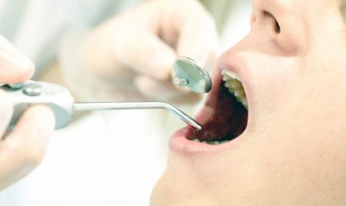 虫歯を放置した際に起こりうる病気とは？